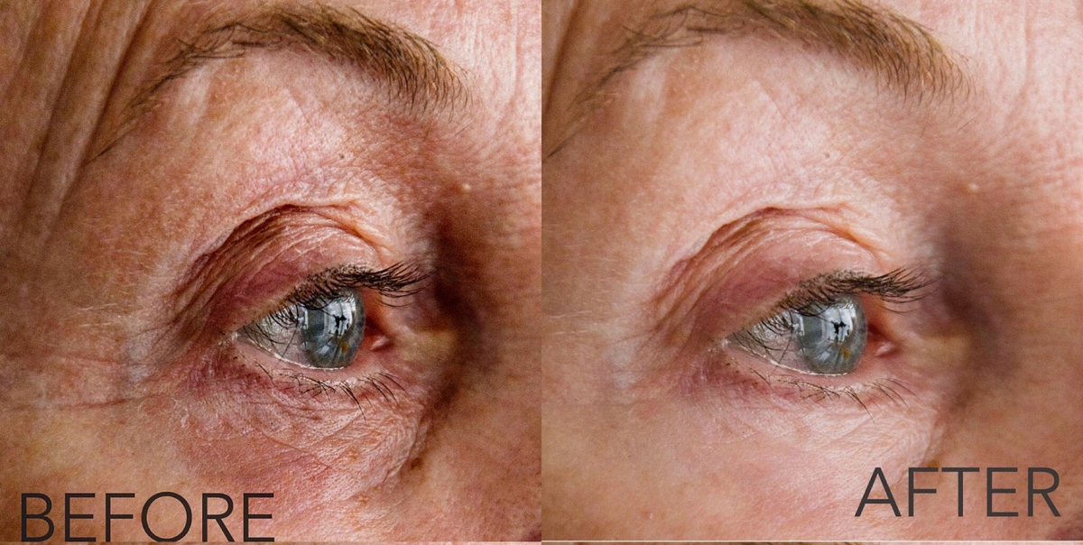 close up of an old woman's eyes