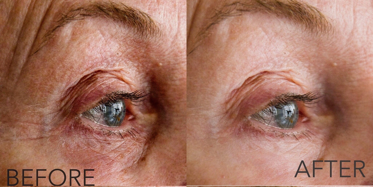 close up of an old woman's eyes