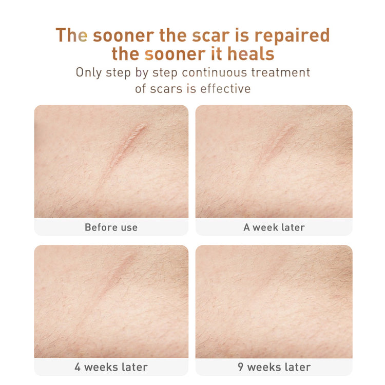 a collage of skin scar