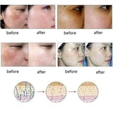 Skin Care Oil