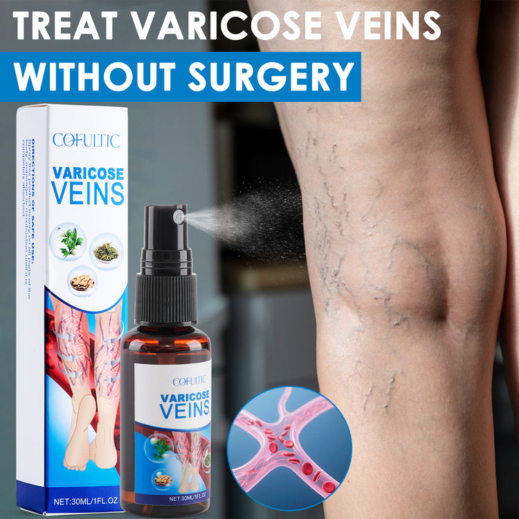a person's leg with varicose veins