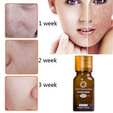 Skin Care Oil