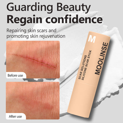 Silicone Scar Care Stick Nourishing And Gentle Skin Care