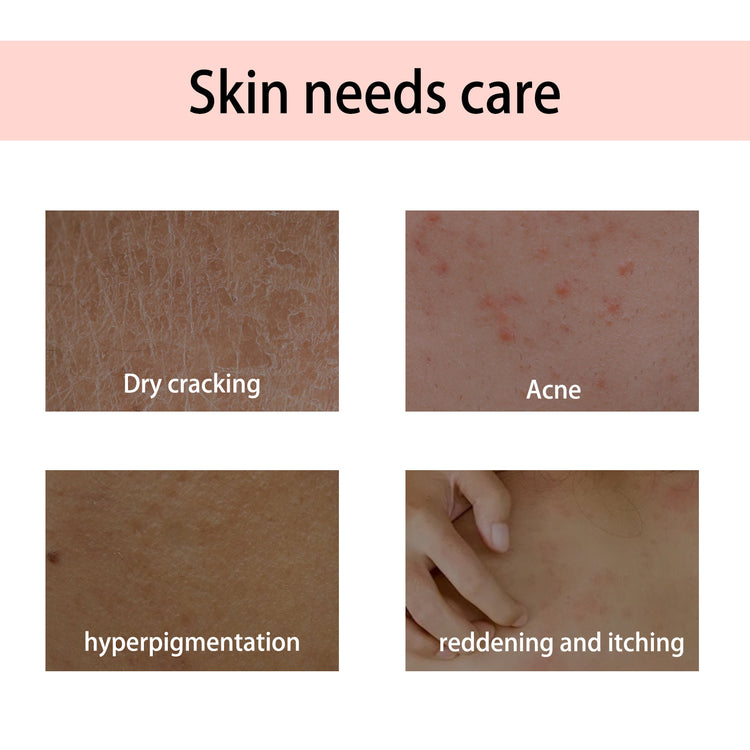 a close-up of skin problems