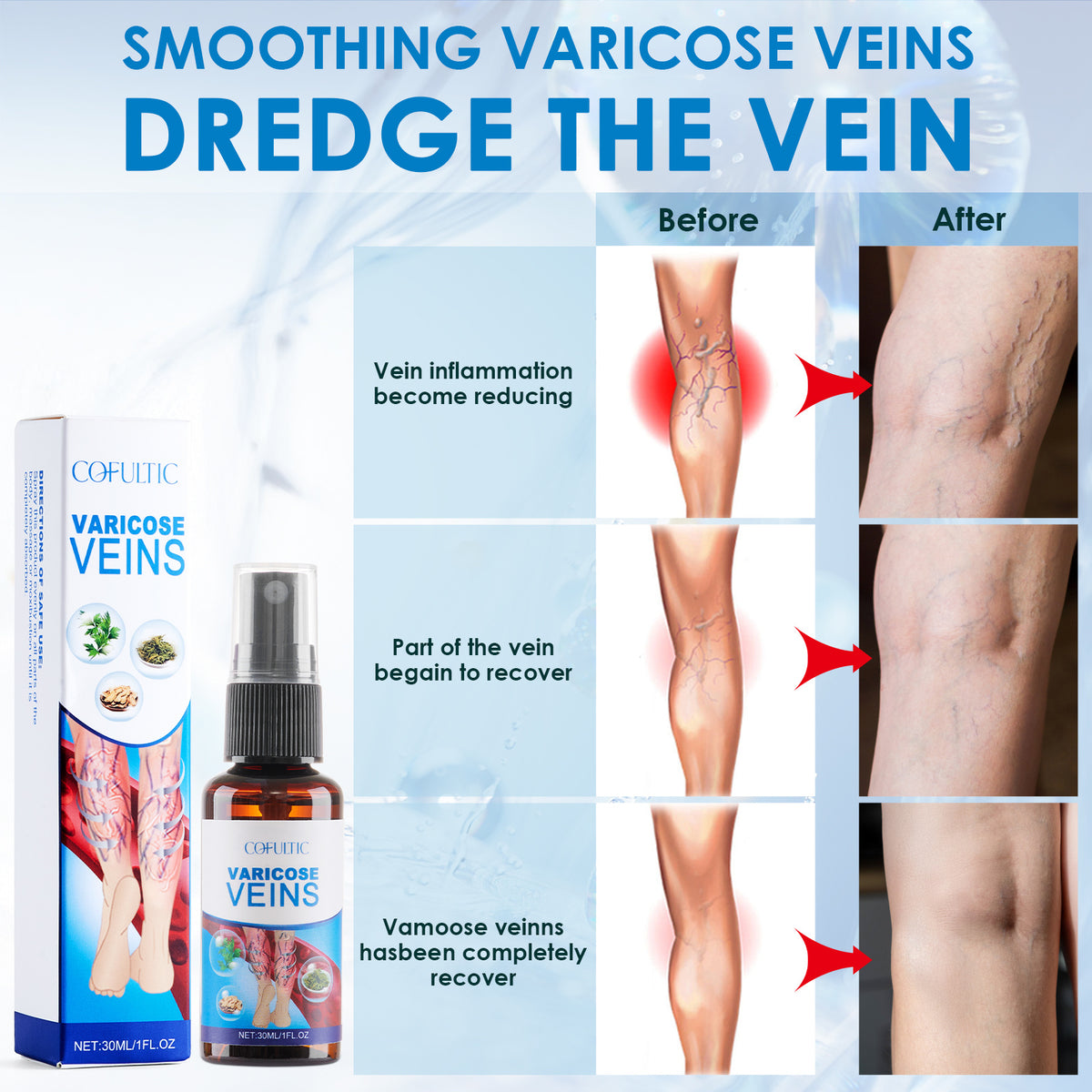 a collage of varicose veins