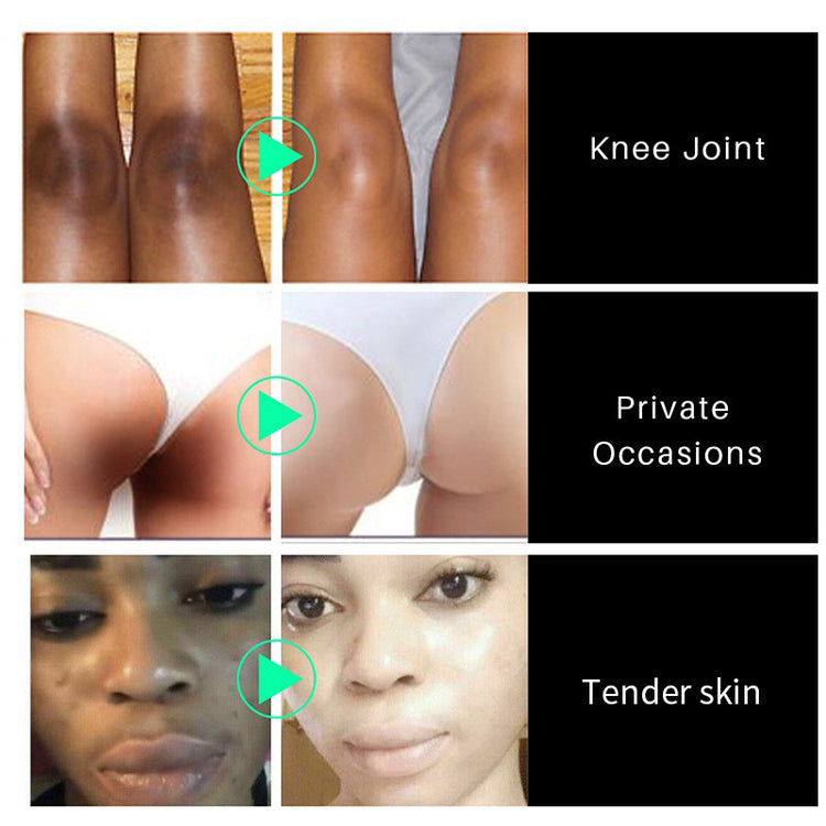 a collage of different images of women's legs