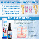 30ml Varicose Vein Spray Multi-Purpose Knee And Leg Care Spray Promote Blood Circulation